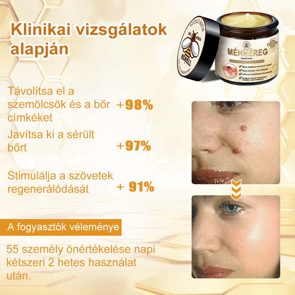 🐝BSWELL® Krém na ošetrenie včelím jedom👨⚕️(MDT recommended) (🔥Posledný deň akcie 80% zľava)