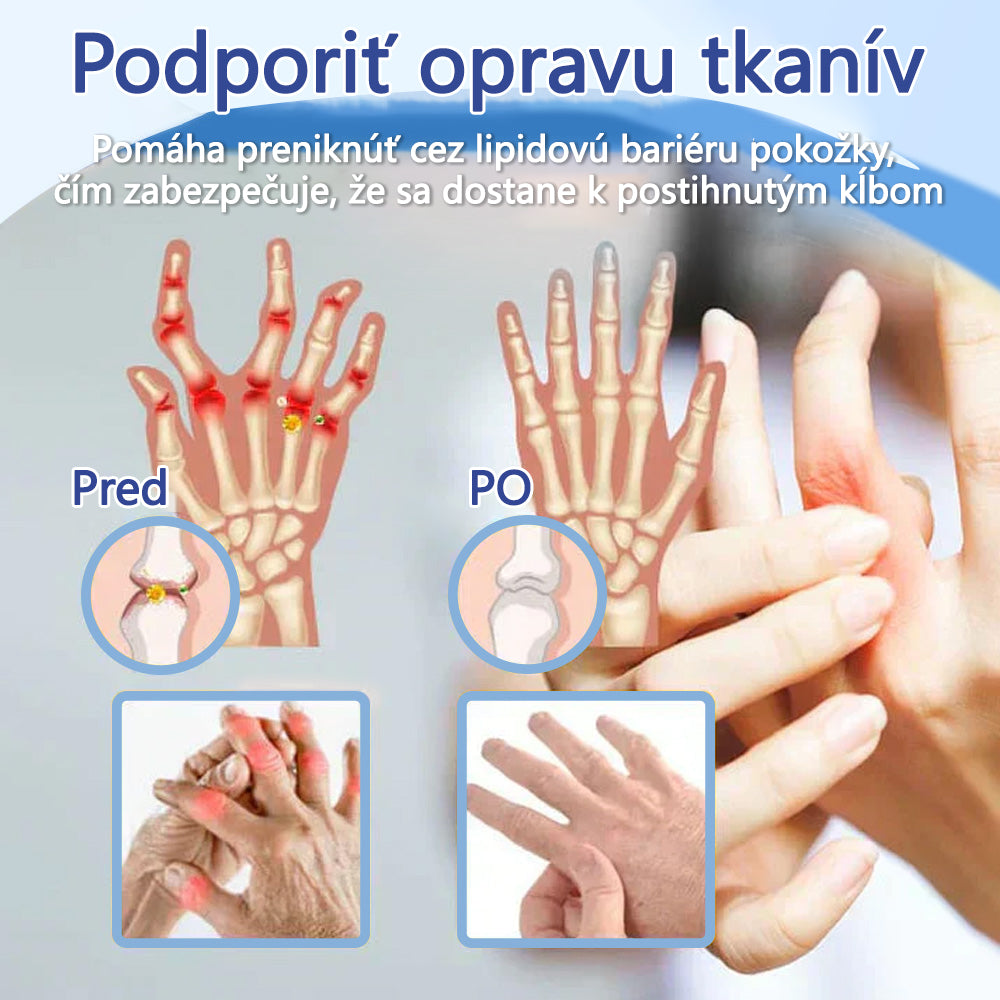 ✅ Schválené ÚVZ SR: Ourlyard® Magnéziový krém na hojenie bolesti kostí (liečba artritídy, neuropatie, reumatických ochorení, svalových kŕčov, zášklbov a športových zranení)