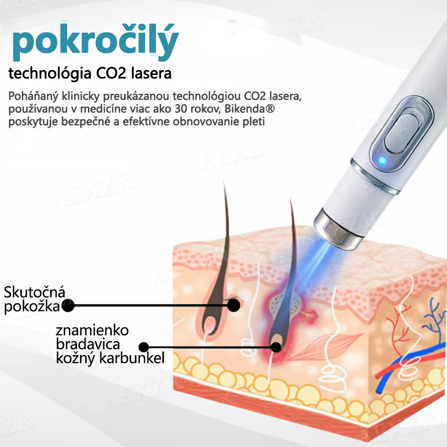 Bikenda® Neinvazívne laserové pero na odstránenie znamienok a bradavíc💥