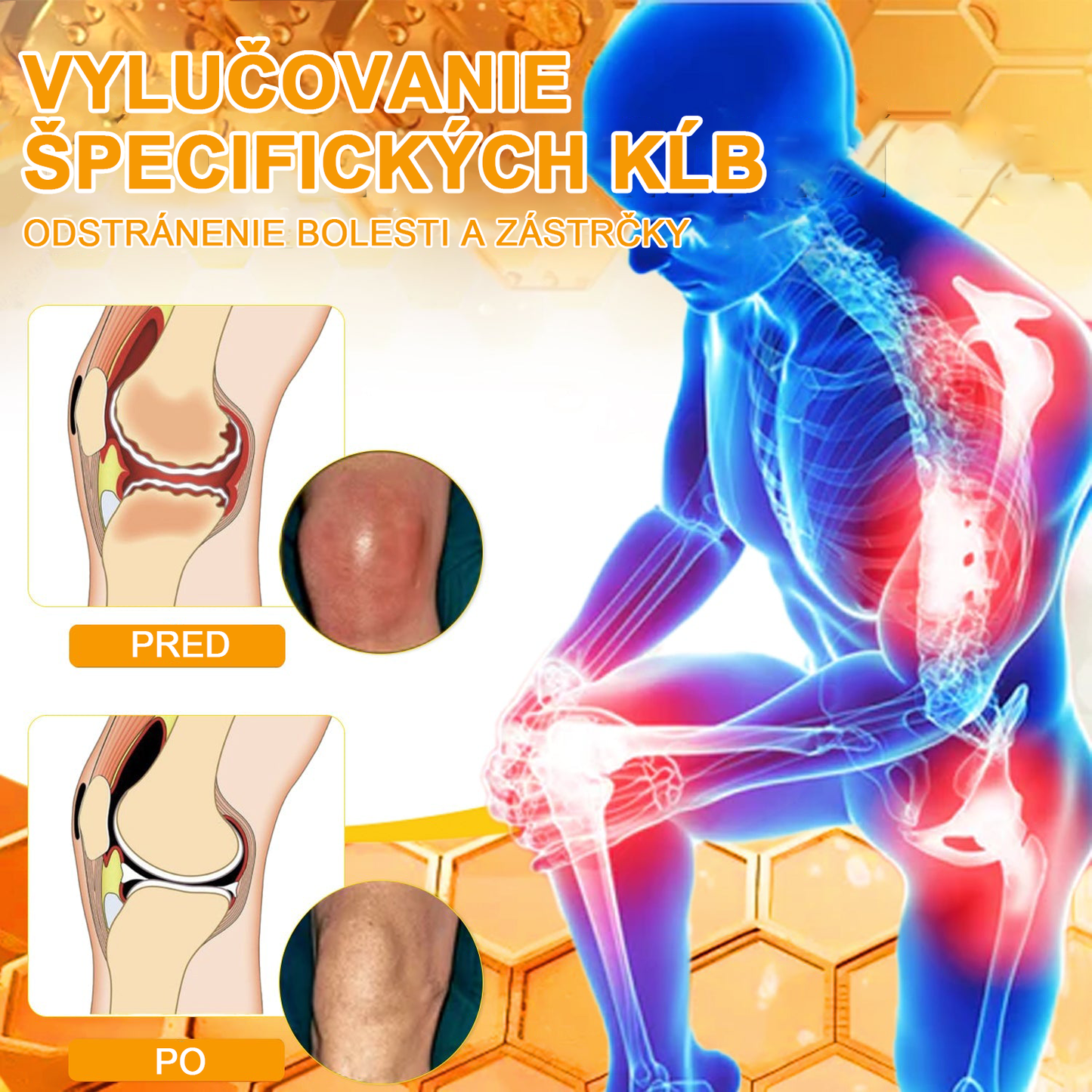 【Oficiálny obchod】 𝗔𝗲𝘁𝗵𝗲𝗿𝗶𝘀™ Včelí jed Ultra Krém na úľavu od bolesti-(Poskytuje odstránenie bolesti pri artritíde, bolesti svalov, chrbta, kolien, chrbta, ramien, bokov, zápästí, rúk)