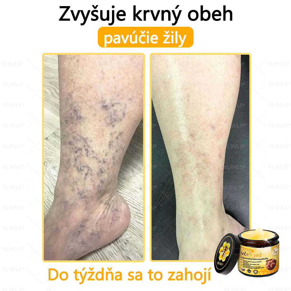 VLSVLS™ Obnovujúci krém na pleť so včelím jedom💥💥💥