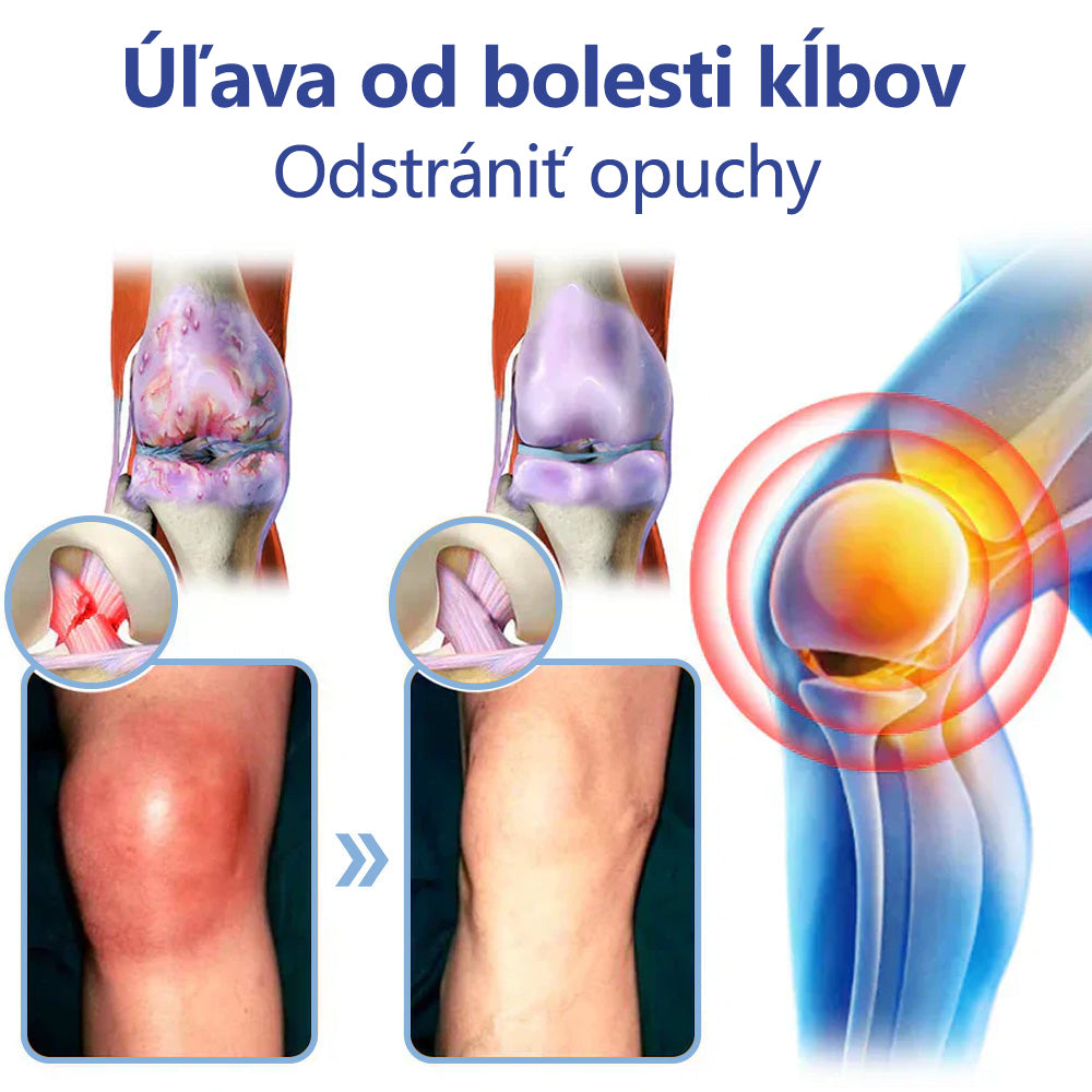 ✅ Schválené ÚVZ SR: Ourlyard® Magnéziový krém na hojenie bolesti kostí (liečba artritídy, neuropatie, reumatických ochorení, svalových kŕčov, zášklbov a športových zranení)