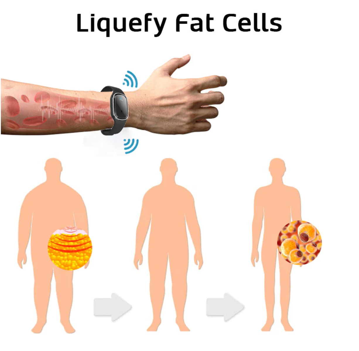 🌱🧑⚕️GFOUK™Ultrazvukový náramok na odstraňovanie tuku a detoxikáciu(🔥POSLEDNÝ DEŇ 70% SLEVA)