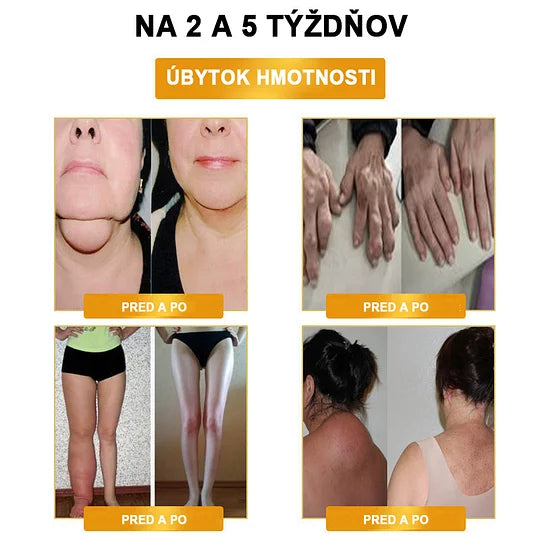 ⌚✨Detoxikačný náramok s ultrazvukovým odbúravaním tukov a diaľkovým infračerveným žiarením pre vyrovnávanie hladiny cukru v krvi - Energy Balance 🔥časovo obmedzená ponuka🔥