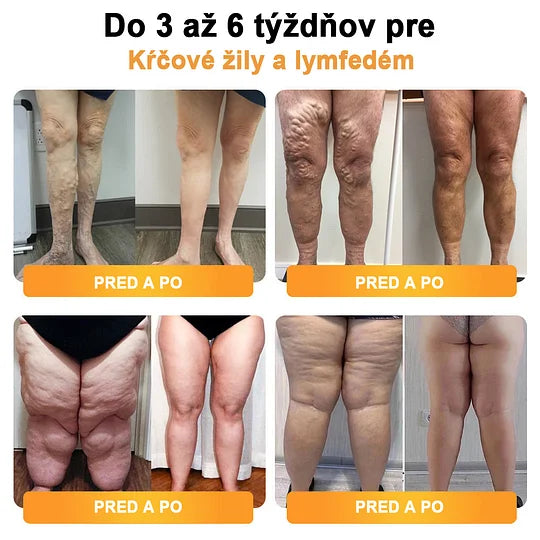 ⌚✨Detoxikačný náramok s ultrazvukovým odbúravaním tukov a diaľkovým infračerveným žiarením pre vyrovnávanie hladiny cukru v krvi - Energy Balance 🔥časovo obmedzená ponuka🔥