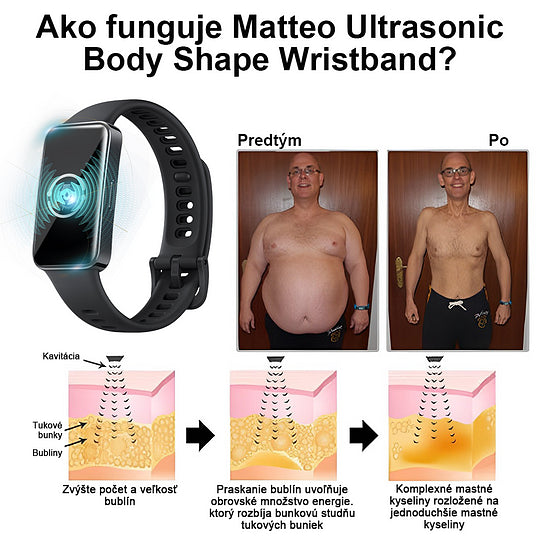 【✨Dobirka✨】2024 Nový ultrazvukový liposukčný detoxikačný náramok SlimPulse™(Odporúčanie lekára👨⚕)