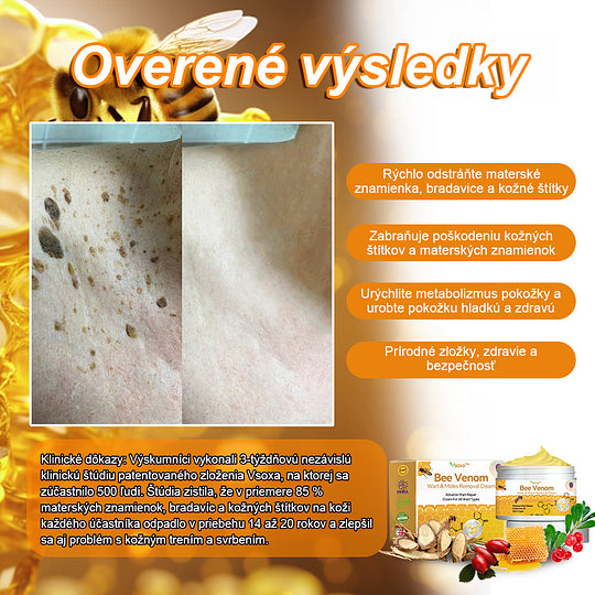 🔥Vsoxa™ Krém na odstránenie bradavíc a krtkov s obsahom včelieho jedu (zľava 80%)