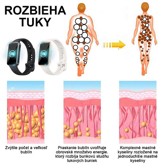 【✨Dobirka✨】2024 Nový ultrazvukový liposukčný detoxikačný náramok SlimPulse™(Odporúčanie lekára👨⚕)