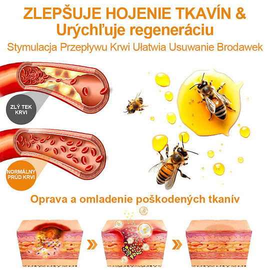 🔥Vsoxa™ Krém na odstránenie bradavíc a krtkov s obsahom včelieho jedu (zľava 80%)