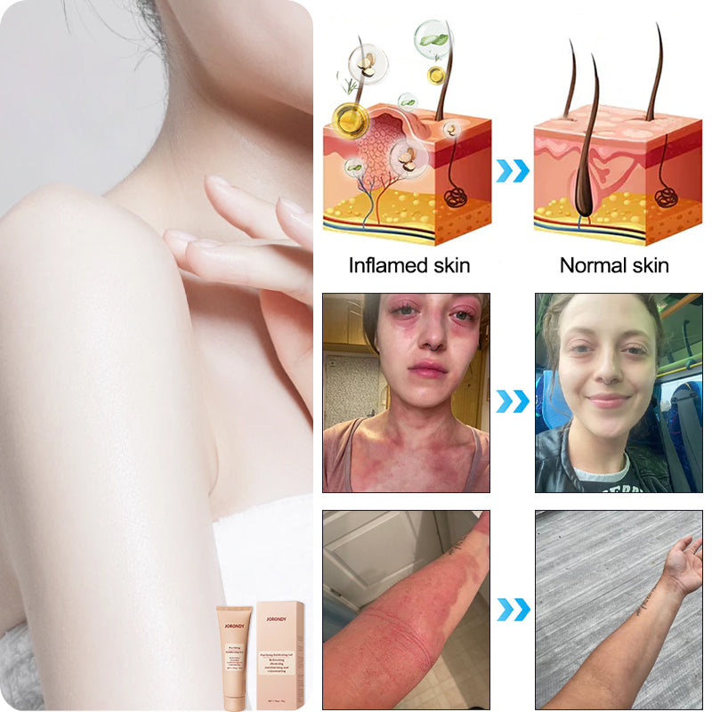 Čistiaci exfoliačný gél na akantózu nigricans, exfoliáciu, tmavé škvrny, kožné jazvy a ekzémy