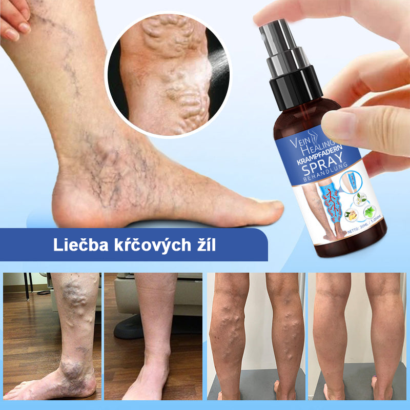 🌱🌠✨Sprej na liečbu kŕčových žíl Veinhealing™🌿