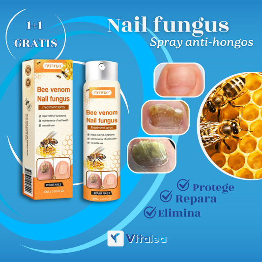 Sprej proti plesniam🧫NailFungus™| 1+1 ZDARMA