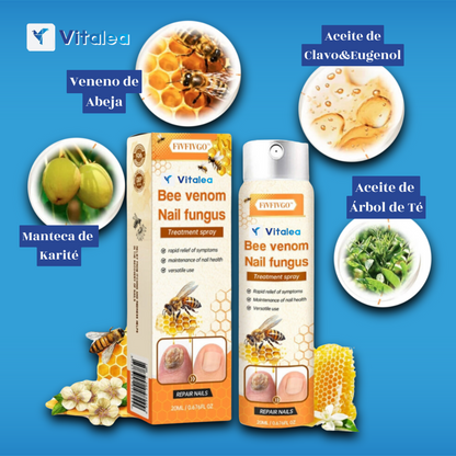 Sprej proti plesniam🧫NailFungus™| 1+1 ZDARMA