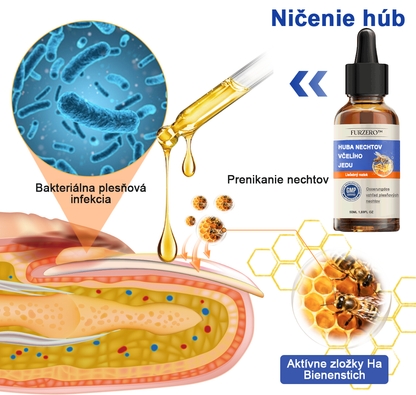 🐝🐝🐝Furzero™ Včelí jed na plesne na nechtoch: kompletné riešenie plesní na nechtoch 🌟👣