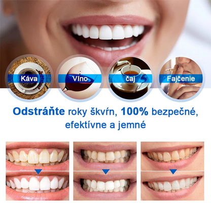 ⏳Časovo obmedzená ponuka⏳LIMETOW™ Esencia na bielenie zubov