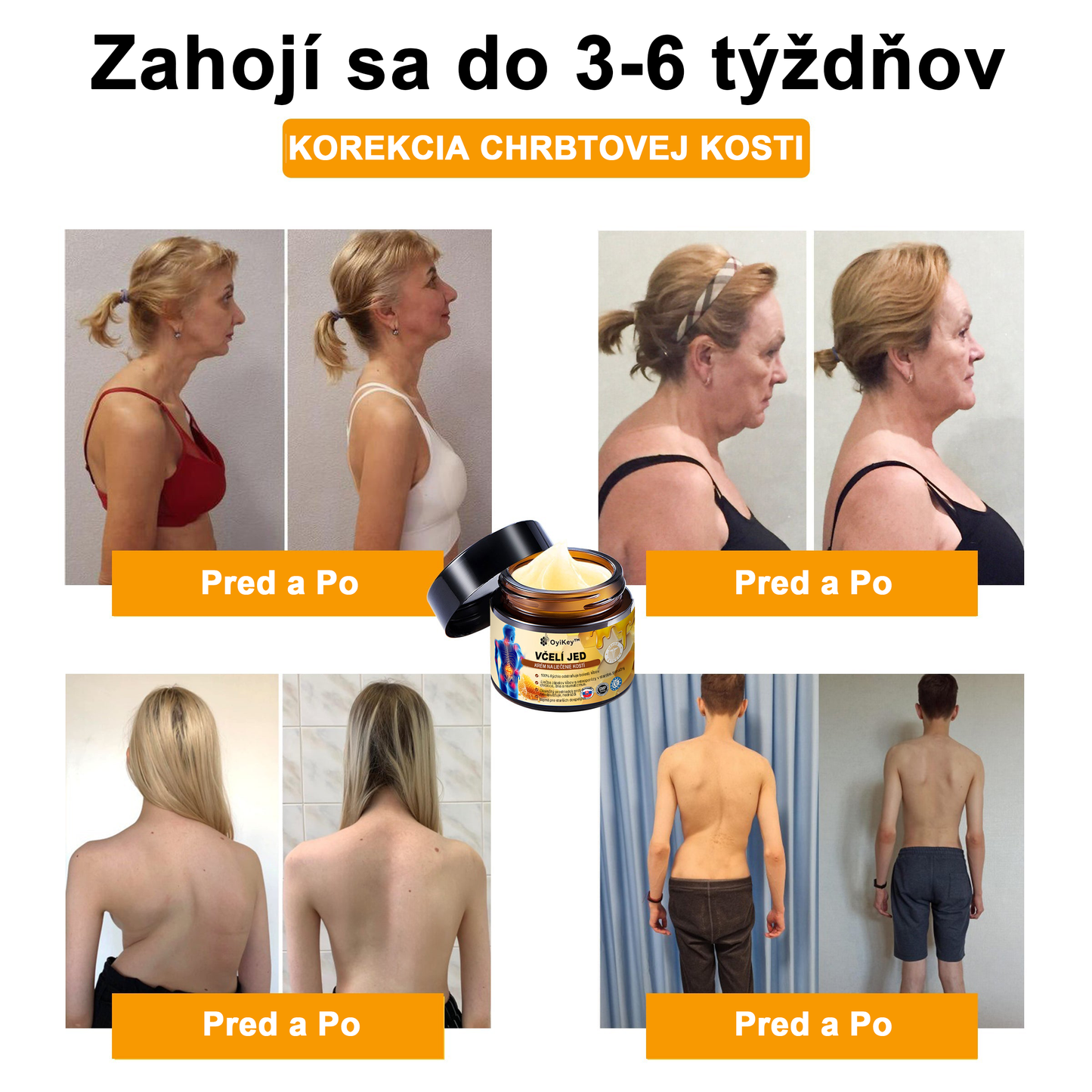 【Oficiálny obchod】 𝗔𝗲𝘁𝗵𝗲𝗿𝗶𝘀™ Včelí jed Ultra Krém na úľavu od bolesti-(Poskytuje odstránenie bolesti pri artritíde, bolesti svalov, chrbta, kolien, chrbta, ramien, bokov, zápästí, rúk)