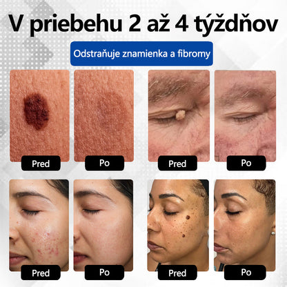 RICPIND® Multifunkčné laserové pero na opravy✨