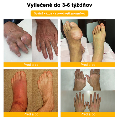 𝑭𝑨𝑻𝑶𝑵𝑮® Krém proti bolesti a hojeniu kostí zo včelieho jedu (výhradne pre seniorov a na odporúčanie NVOC)🧨