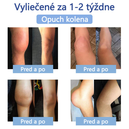 ✅ Schválené ÚVZ SR: Ourlyard® Magnéziový krém na hojenie bolesti kostí 🔥(liečba artritídy, neuropatie, reumatických ochorení, svalových kŕčov, zášklbov a športových zranení)🌱