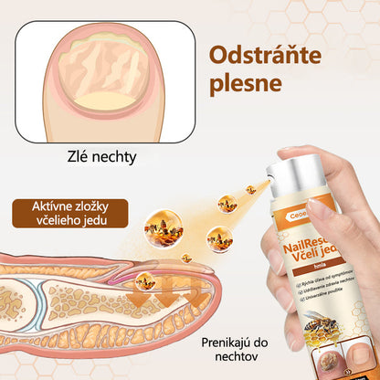 2025🎁 Limitovaná akcia 70% ZĽAVA ️ ️⏳ Ceoerty® Sprej na nechtovú hubu s včelím jedom 💥 Oprava všetkých problémov s nechtami do 2 týždňov