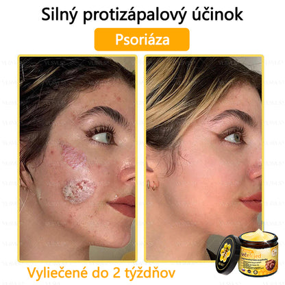 VLSVLS™ Obnovujúci krém na pleť so včelím jedom💥💥💥