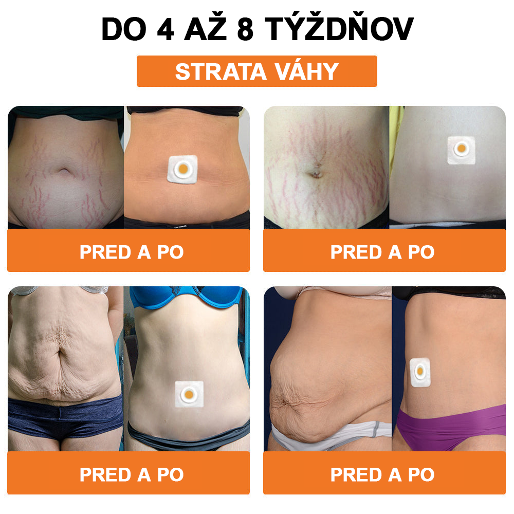 🐝Swan Bella™ Lymfodrenážna náplasť na chudnutie so včelím jedom 🔥 70% zľava na obmedzený čas 🔥 (Vhodné pre všetky vekové kategórie).