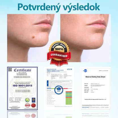 RICPIND® Multifunkčné laserové pero na opravy✨