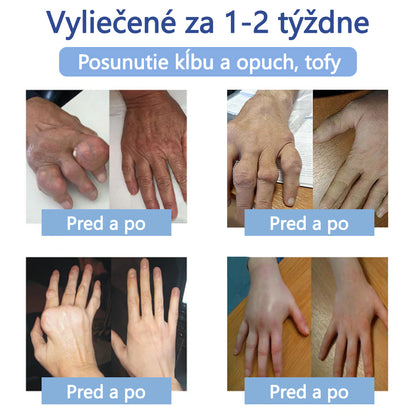 ✅ Schválené ÚVZ SR: Ourlyard® Magnéziový krém na hojenie bolesti kostí 🔥(liečba artritídy, neuropatie, reumatických ochorení, svalových kŕčov, zášklbov a športových zranení)🌱