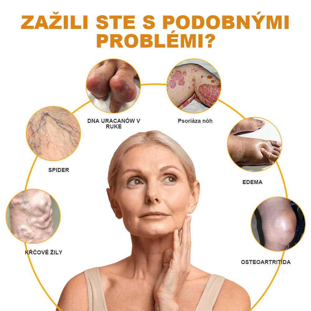 🏆🌈[✨Oficiálny obchod značky✨]Zoencgz™ Krém na liečbu artritídy a kŕčových žíl so včelím jedom（AVLS & ACR RECOMMENDS）
