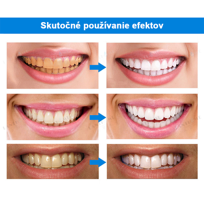 ⏳Časovo obmedzená ponuka⏳LIMETOW™ Esencia na bielenie zubov