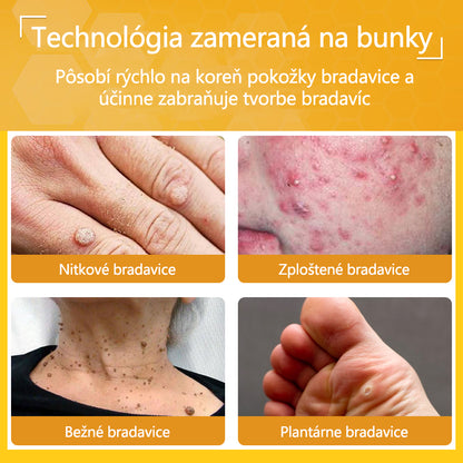 ✅flysmus® Silný krém s včelím jedom – Odporúčaný dermatologickými odborníkmi. Účinný proti bradaviciam, hrčkám, léziám, infekciám a jazvám.🐝🐝
