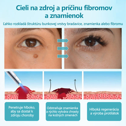 RICPIND® Multifunkčné laserové pero na opravy✨