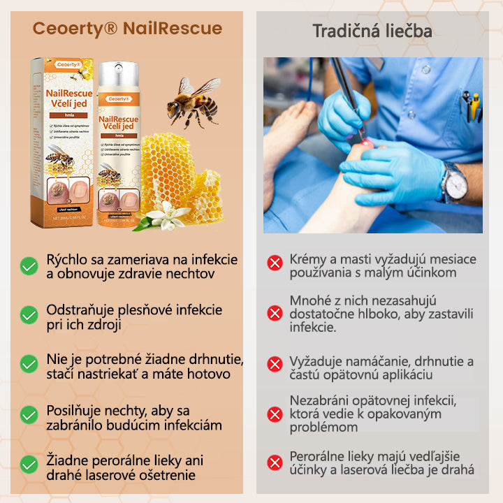 2025🎁 Limitovaná akcia 70% ZĽAVA ️ ️⏳ Ceoerty® Sprej na nechtovú hubu s včelím jedom 💥 Oprava všetkých problémov s nechtami do 2 týždňov