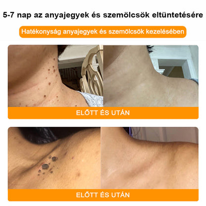 🐝BSWELL® Krém na ošetrenie včelím jedom👨‍⚕️（MDT recommended） (🔥Posledný deň akcie 80% zľava）