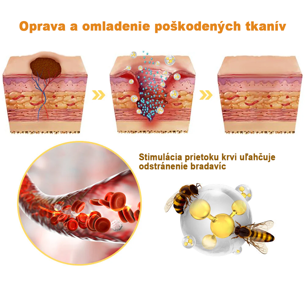 🌈🐝AEXZR™ Krém na liečbu bradavíc zo včelieho jedu
