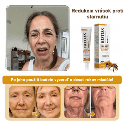 🍀Posledný deň akcie: 70% zľava - ✨Furzero™ Botoxový krém na odstránenie vrások od včelieho jedu