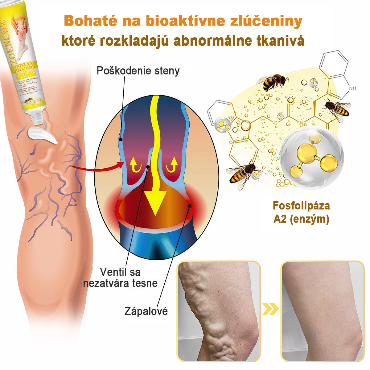 🏆🌈[✨Oficiálny obchod značky✨]Zoencgz™ Krém na liečbu artritídy a kŕčových žíl so včelím jedom（AVLS & ACR RECOMMENDS）