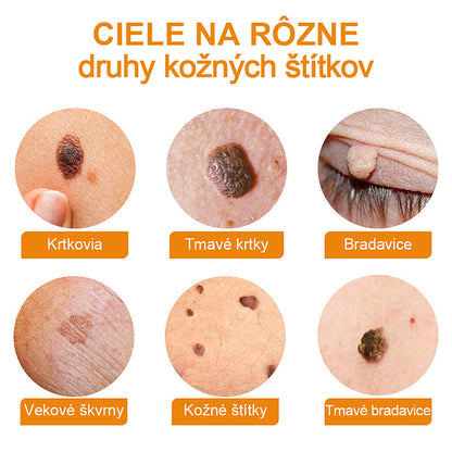 🔥Vsoxa™ Krém na odstránenie bradavíc a krtkov s obsahom včelieho jedu (zľava 80%)