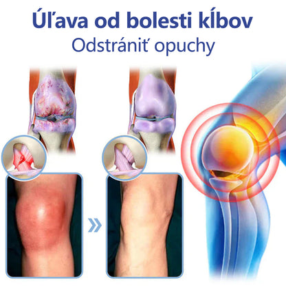 ✅ Schválené ÚVZ SR: Ourlyard® Magnéziový krém na hojenie bolesti kostí 🔥(liečba artritídy, neuropatie, reumatických ochorení, svalových kŕčov, zášklbov a športových zranení)🌱