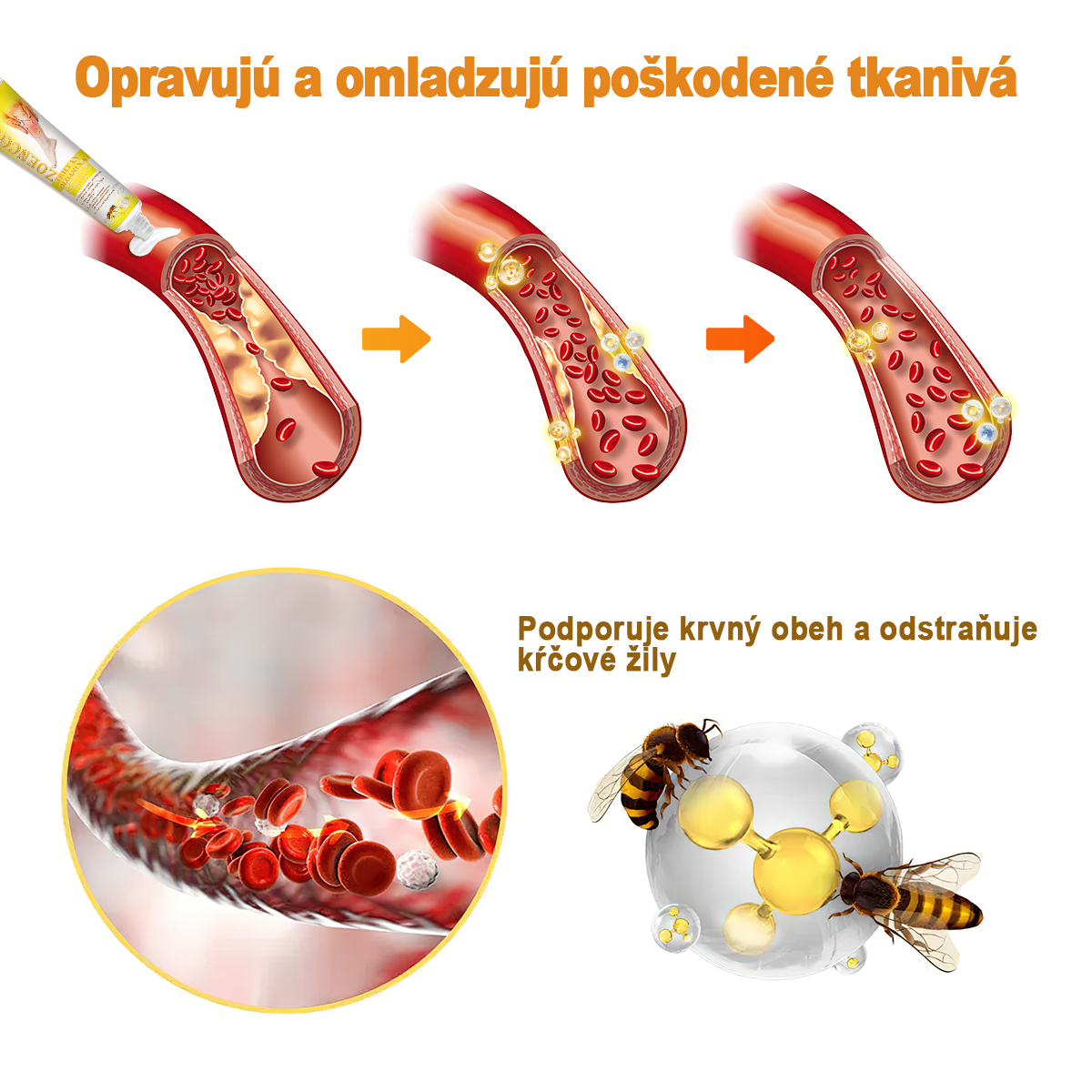 🏆🌈[✨Oficiálny obchod značky✨]Zoencgz™ Krém na liečbu artritídy a kŕčových žíl so včelím jedom（AVLS & ACR RECOMMENDS）