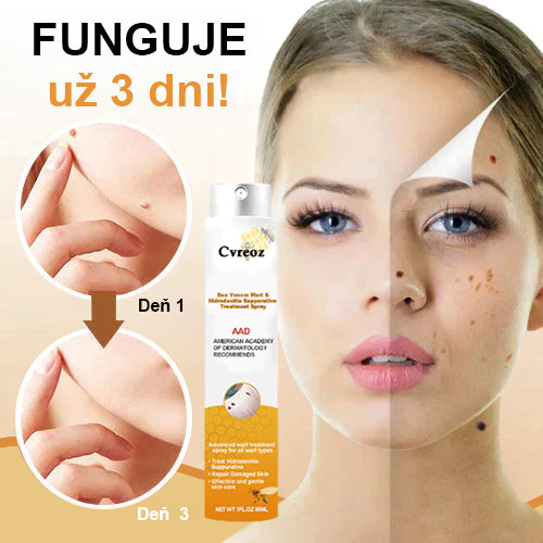 🧡Cvreoz Včelí jed na odstraňovanie bradavíc a značiek v spreji(👨‍⚕AAD ODPORÚČA)🐝🐝(🔥Posledný deň akcie 80% zľava)