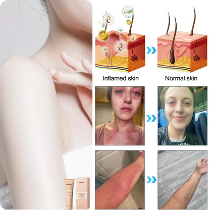 Čistiaci exfoliačný gél na akantózu nigricans, exfoliáciu, tmavé škvrny, kožné jazvy a ekzémy