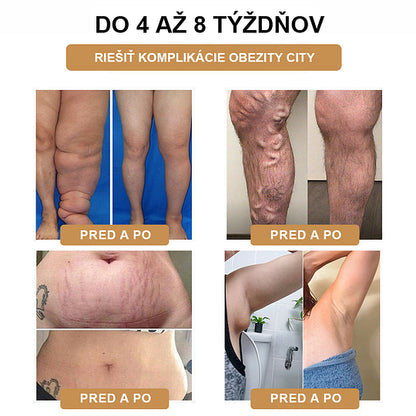 【✨Dobirka✨】2024 Nový ultrazvukový liposukčný detoxikačný náramok SlimPulse™(Odporúčanie lekára👨‍⚕)